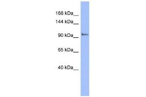 PI4KB antibody used at 1 ug/ml to detect target protein. (PI4KB anticorps  (N-Term))