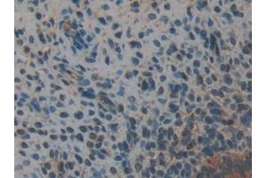 Detection of ANXA2 in Mouse Uterus Tissue using Polyclonal Antibody to Annexin A2 (ANXA2)