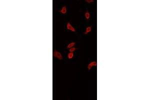ABIN6268871 staining PC-12 cells by IF/ICC. (beta Synuclein anticorps  (C-Term))