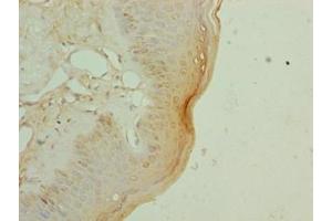 Immunohistochemistry of paraffin-embedded human skin tissue using ABIN7152281 at dilution of 1:100