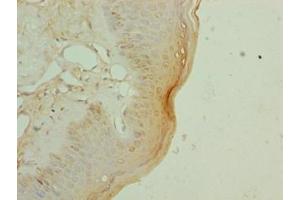 Immunohistochemistry of paraffin-embedded human skin tissue using ABIN7152281 at dilution of 1:100 (EXOSC1 anticorps  (AA 9-195))