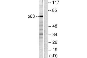 Western Blotting (WB) image for anti-T-Complex 1 (TCP1) (C-Term) antibody (ABIN1848722) (TCP1 alpha/CCTA anticorps  (C-Term))
