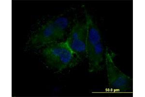 Immunofluorescence of monoclonal antibody to CD44 on HepG2 cell. (CD44 anticorps)