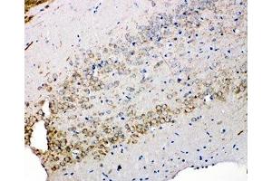 IHC-P: Syndecan 3 antibody testing of rat brain tissue (SDC3 anticorps  (N-Term))