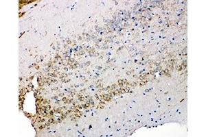 IHC-P: Syndecan 3 antibody testing of rat brain tissue