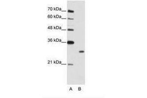 Image no. 1 for anti-Muscleblind-like Protein 1 (MBNL1) (C-Term) antibody (ABIN202283) (MBNL1 anticorps  (C-Term))