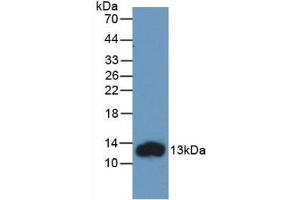 Detection of Recombinant FABP1, Human using Monoclonal Antibody to Fatty Acid Binding Protein 1 (FABP1)