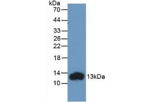 Detection of Recombinant FABP1, Human using Monoclonal Antibody to Fatty Acid Binding Protein 1 (FABP1) (FABP1 anticorps  (AA 2-127))