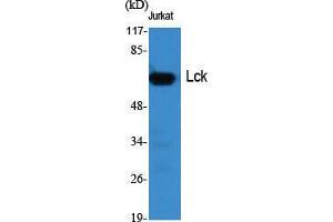 Western Blot (WB) analysis of specific cells using Lck Polyclonal Antibody. (LCK anticorps  (Ser736))