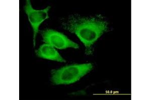 Image no. 1 for anti-Eukaryotic Translation Initiation Factor 5 (EIF5) (AA 1-432) antibody (ABIN598657) (EIF5 anticorps  (AA 1-432))