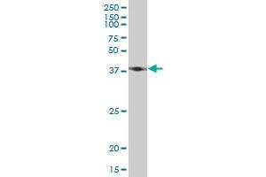 ACTB monoclonal antibody (M03), clone 1E7. (beta Actin anticorps  (AA 1-375))