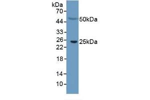 Mouse Capture antibody from the kit in WB with Positive Control: Human serum. (CRP Kit ELISA)