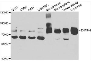 Western blot analysis of extracts of various cell lines, using ZNF544 antibody. (ZNF544 anticorps)