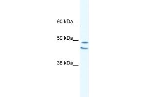 WB Suggested Anti-EGR2 Antibody Titration:  0. (EGR2 anticorps  (C-Term))