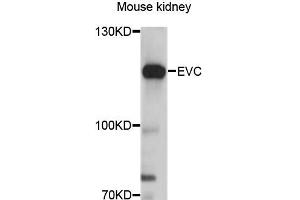 Western blot analysis of extracts of mouse kidney, using EVC antibody (ABIN6290358) at 1:3000 dilution. (EVC anticorps)