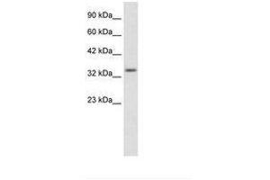Image no. 2 for anti-Zinc Finger Protein 134 (ZNF134) (AA 128-177) antibody (ABIN203066) (ZNF134 anticorps  (AA 128-177))