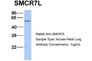 Host:  Rabbit  Target Name:  SMCR7L  Sample Type:  Human Fetal Lung  Antibody Dilution:  1. (SMCR7L anticorps  (N-Term))