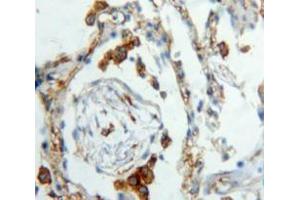 IHC-P analysis of Lung tissue, with DAB staining. (XCL1 anticorps  (AA 23-113))