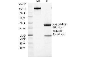 SDS-PAGE Analysis Purified ACTH Mouse Recombinant Monoclonal Antibody (rCLIP/1407). (POMC anticorps  (AA 25-39))