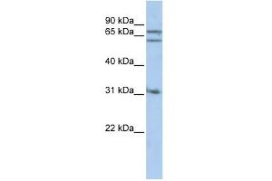 Gephyrin antibody used at 1 ug/ml to detect target protein.