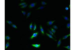 Immunofluorescence staining of HepG2 cells with ABIN7154521 at 1:133, counter-stained with DAPI.