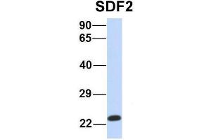 Host:  Rabbit  Target Name:  SDF2  Sample Type:  Human MCF7  Antibody Dilution:  1. (SDF2 anticorps  (Middle Region))