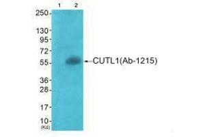 Western blot analysis of extracts from COS7 cells (Lane 2), using APLF (Ab-116) antiobdy. (APLF anticorps  (Ser116))