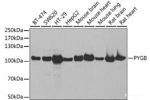 Western blot analysis of extracts of various cell lines using PYGB Polyclonal Antibody at dilution of 1:1000. (PYGB anticorps)