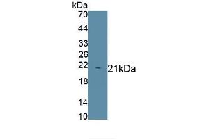 Detection of Recombinant Hpt, Human using Monoclonal Antibody to Haptoglobin (Hpt)