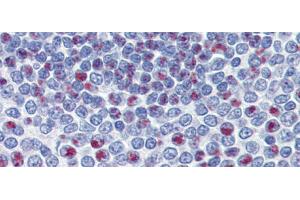 Immunohistochemistry with Human Spleen lysate tissue at an antibody concentration of 5. (FOXM1 anticorps  (Middle Region))