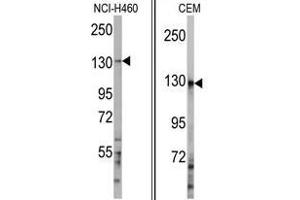 anti-Ubiquitination Factor E4A (UBE4A) (C-Term) antibody