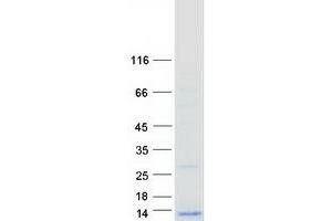 Validation with Western Blot