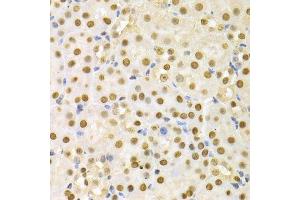 Immunohistochemistry of paraffin-embedded mouse kidney using SFN Antibody. (14-3-3 sigma/SFN anticorps  (AA 1-248))