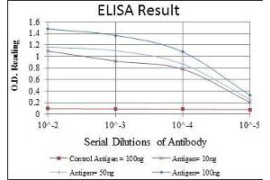 Red: Control Antigen (100 ng), Purple: Antigen (10 ng), Green: Antigen (50 ng), Blue: Antigen (100 ng), (TNNI2 anticorps)