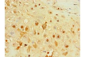 Immunohistochemistry of paraffin-embedded human placenta tissue using ABIN7156651 at dilution of 1:100 (IFIH1 anticorps  (AA 700-1025))