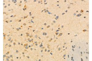 ABIN6260084 and ABIN6273196 at 1/100 staining Mouse brain tissue by IHC-P. (ASRGL1 anticorps  (Internal Region))