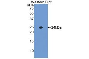 Western blot analysis of the recombinant protein. (Chemokine (C-X-C Motif) Ligand 15 (CXCL15) (AA 26-167) anticorps)