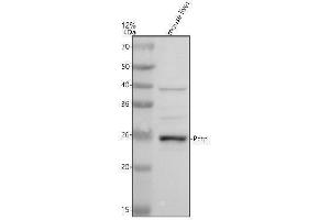 Western blot analysis of PCTP using anti-PCTP antibody (ABIN7825678).