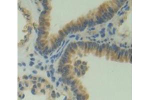 IHC-P analysis of Kidney tissue, with DAB staining. (PLEKHA1 anticorps  (AA 105-351))