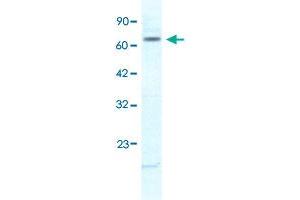Western Blot analysis of Jurkat cell lysate with KCNH6 polyclonal antibody  at 1. (KCNH6 anticorps  (N-Term))