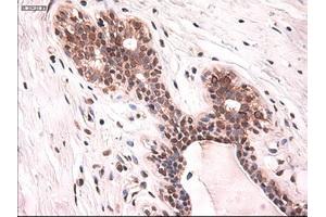 Immunohistochemical staining of paraffin-embedded breast using anti-KRT18 (ABIN2452674) mouse monoclonal antibody. (Cytokeratin 18 anticorps  (AA 69-372))