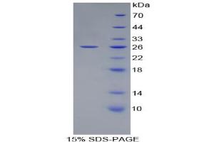 SDS-PAGE analysis of Rat ATF4 Protein.