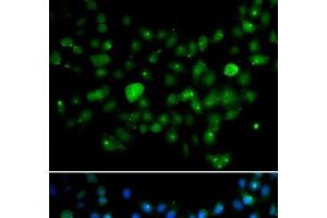 Immunofluorescence analysis of A549 cells using MCM10 Polyclonal Antibody (MCM10 anticorps)