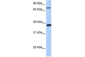 WB Suggested Anti-DIDO1 Antibody Titration:  0. (DIDO1 anticorps  (C-Term))