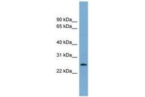 Image no. 1 for anti-Lin-37 Homolog (LIN37) (AA 71-120) antibody (ABIN6744172)