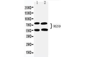 Anti-RGS9 antibody, Western blotting Lane 1: Rat Brain Tissue Lysate Lane 2: Mouse Brain Tissue Lysate (RGS anticorps  (C-Term))