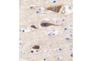 Formalin-fixed and paraffin-embedded human brain tissue reacted with CYP2R1 antibody , which was peroxidase-conjugated to the secondary antibody, followed by DAB staining.