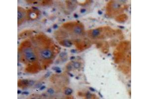 IHC-P analysis of Liver tissue, with DAB staining. (Clusterin anticorps  (AA 227-447))
