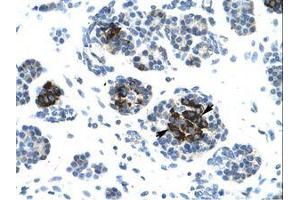 Image no. 1 for anti-Ligase IV, DNA, ATP-Dependent (LIG4) (AA 275-324) antibody (ABIN202951)