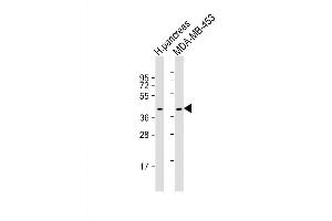 Western Blot at 1:2000 dilution Lane 1: human pancreas lysate Lane 2: MDA-MB-453 whole cell lysate Lysates/proteins at 20 ug per lane.